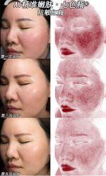 -Yestar重庆艺星医疗美容医院