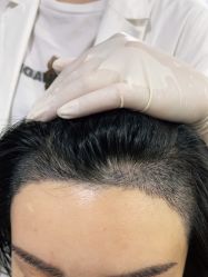 -熙朵美学植发·连锁品牌