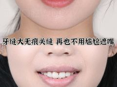 -绿地·中山里