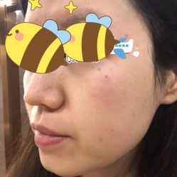 体验前-坤如玛丽·医疗美容中心