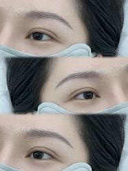 点击看大图 -张小野·专业半永久纹眉