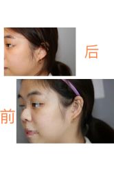 -ROYEA茹彦祛痘·问题肌肤修护中心