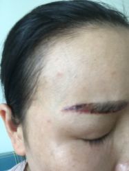 -空军总医院激光整形美容中心