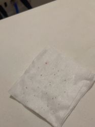-苑苑vbeauty科技美容SPA