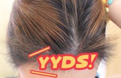 -大麦微针植发丨全国连锁