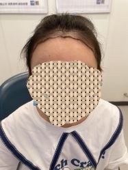 -大麦微针植发全国连锁