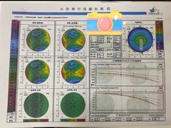 -美尔目眼科医院·近视手术·儿童近视(通州店)
