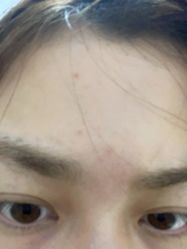 体验后-上海玫瑰医疗美容医院