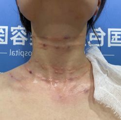 -蚌埠国色医疗美容医院•眼鼻整形