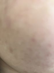 点击看大图 -重庆军科整形美容医院