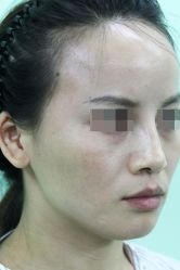 -圣嘉新医疗美容医院