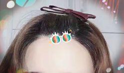 -大麦微针植发全国连锁