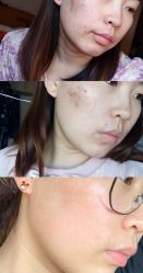 -素妍印象Ekrin Medi Clinic