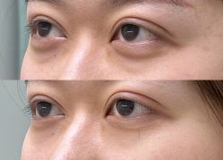 -CMS西美斯·美式医疗美容