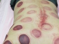 -沈师傅盲人按摩工作室(密三小区店)