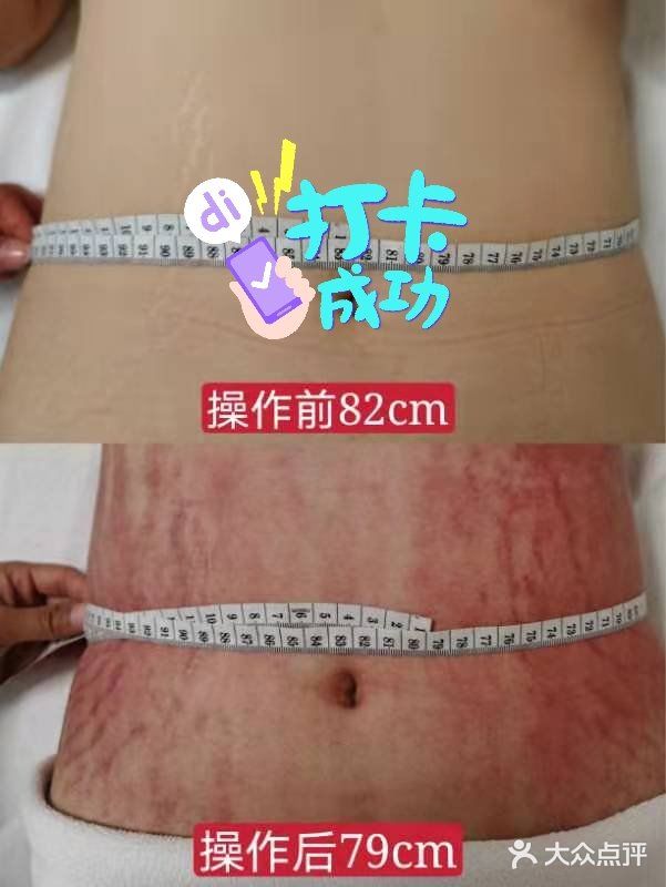 瘦成一道闪电，亮瞎你们的眼💖💖