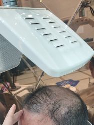 -碧莲盛·不剃发植发