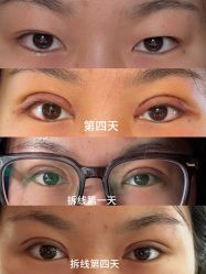 -南京美莱医疗美容·旗舰店