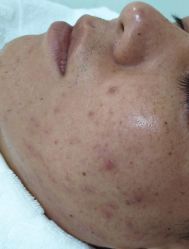 -痘博士北京·全国连锁祛痘机构