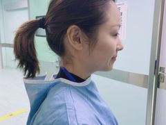 -黑马眼科·近视手术
