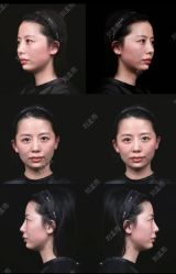 -木兰清颜医疗美容