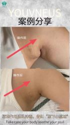 -半岛故事·法儿曼抗衰·indiba中心