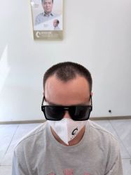 -唐风采假发补发定制