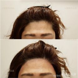 -小梨·OndaPro·专业脱毛连锁机构