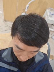 -大麦微针植发丨全国连锁