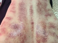-鸿福推拿养生馆(砬子山店)