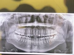 -安柏口腔(海珠世纪云顶店)