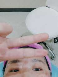 体验后-北京米扬丽格医疗美容·联合丽格鼻整形中心