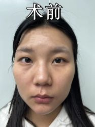 -素美医疗美容·西南眼鼻整形·修复基地