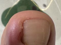 -郑远元专业修脚房(番禺路店)