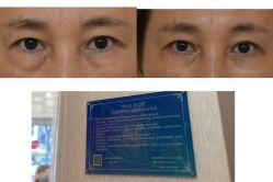 点击看大图 -广州健丽·去眼袋医疗美容机构