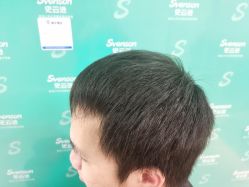 点击看大图 -雍禾植发全国连锁