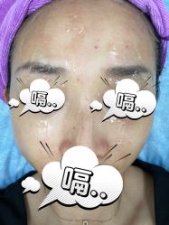 体验后-美莱医疗美容医院