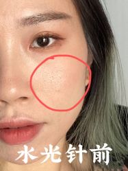 -上海漾颜医疗美容
