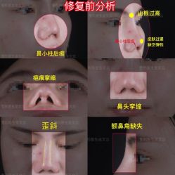 -北京米扬丽格医疗美容·联合丽格鼻整形中心