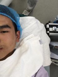 -痘博士烟台·全国连锁祛痘机构