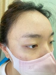 点击看大图 体验前-重庆联合丽格第五医疗美容医院