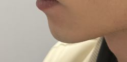 -Yestar 嘉兴艺星医疗美容医院