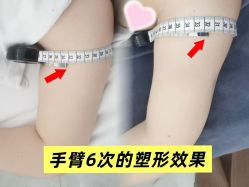 -Lily纤美·科技减脂中心