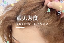 -大麦微针植发全国连锁