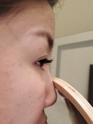 -郡艺医疗美容·微整·眼鼻吸脂
