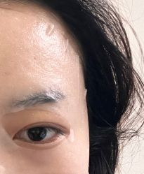 -素美医疗美容·西南眼鼻整形·修复基地