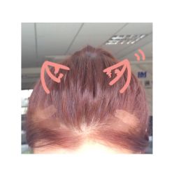 iphone_upload_pic-发饰美男士增发补发假发定制店