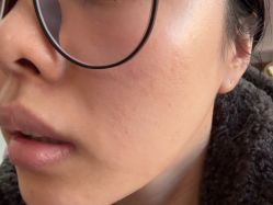 点击看大图 -广州美莱医疗美容医院