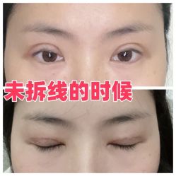 -素美医疗美容·西南眼鼻整形·修复基地
