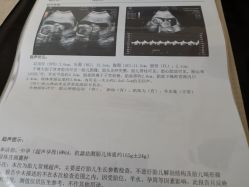 -武汉都市妇产医院